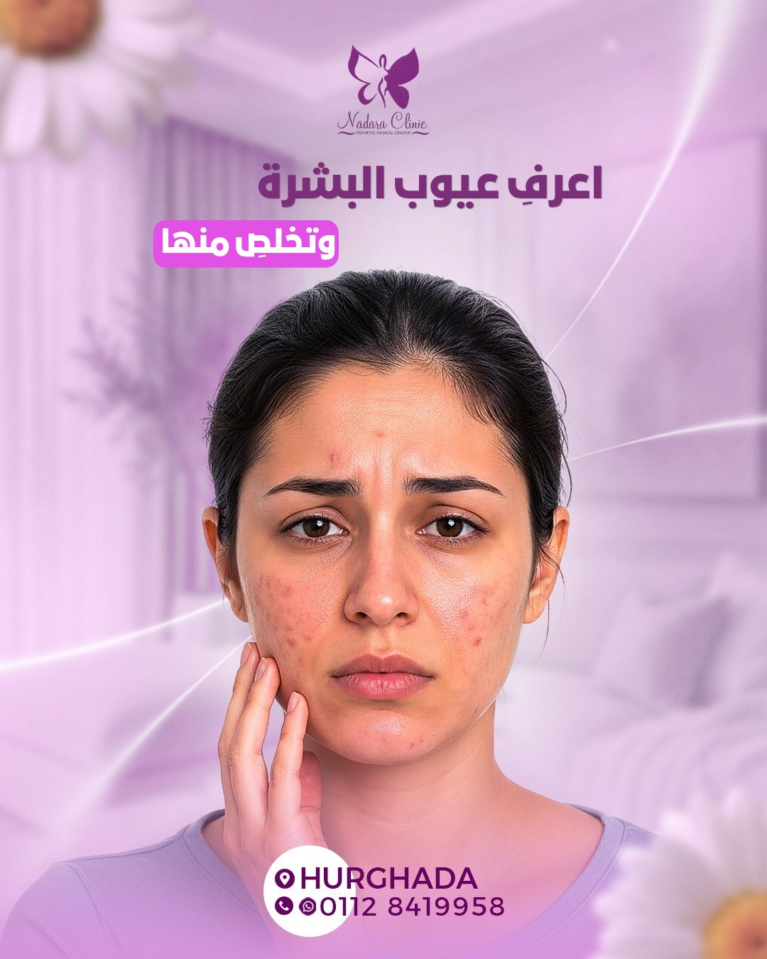 اعرفِ عيوب البشرة وتخلصِ منها
